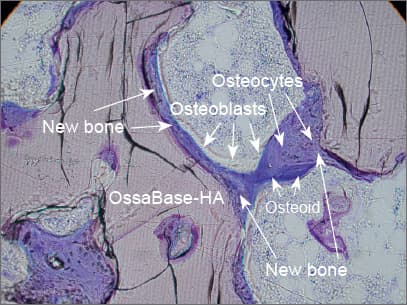 Histologie — Osteokonduktion im Detail